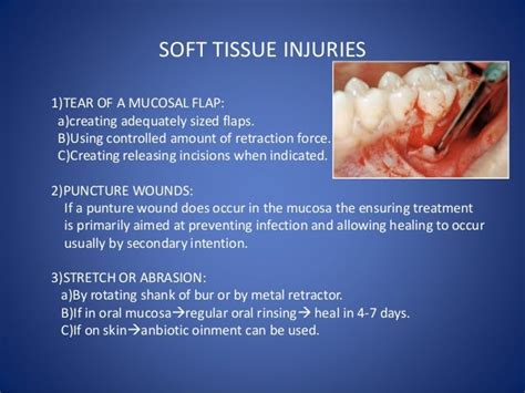 Complications of tooth extraction and its management (oral surgery)