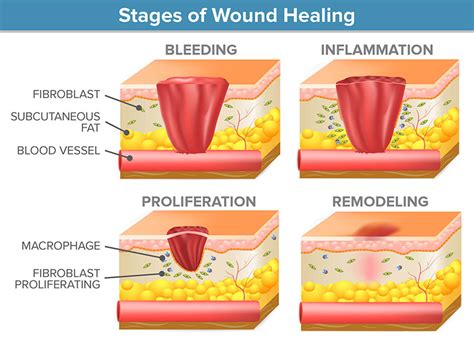 How do wounds heal? – Scientific Scribbles