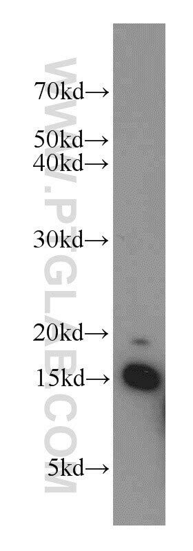 LC3 Antibody (14600-1-AP)