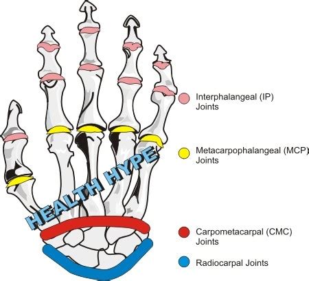 Wrist Pain Anatomy, Causes, Symptoms, Diagnosis and Treatment | Healthhype.com