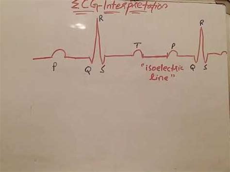 ECG |isoelectric line| |ISM| - YouTube