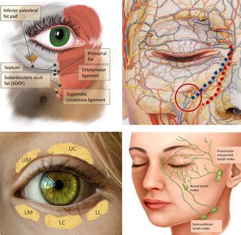 Recommendations for the treatment of tear trough deformity with cross‐linked hyaluronic acid ...