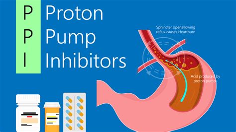 Proton Pump Inhibitors – Doctall Living