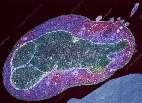 Malaria parasite, TEM - Stock Image - M210/0210 - Science Photo Library