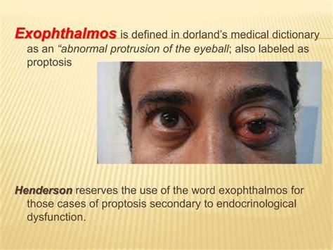 Evaluation of proptosis