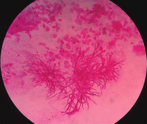 Aspergillus Conidiophores Gram Stain