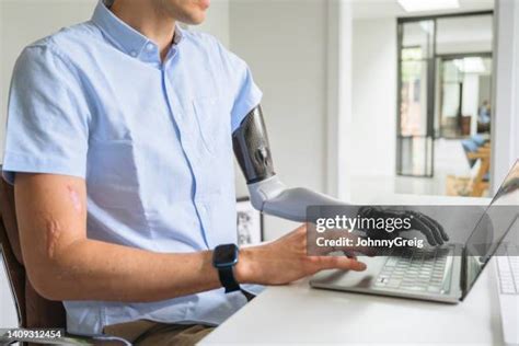 Bionic Arm Photos and Premium High Res Pictures - Getty Images