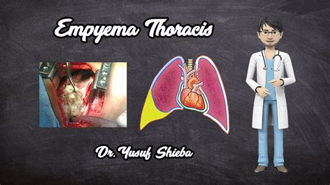 Empyema Thoracis: Pathology, Bacteriology, Clinical Features, Diagnosis and Treatment - CtsQena