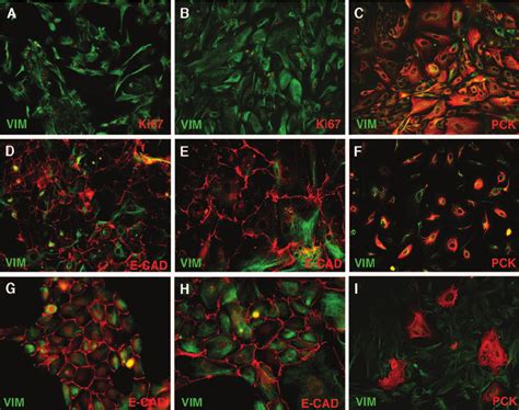 Expression of epithelial and mesenchymal markers. A and B : Fluorescein ...