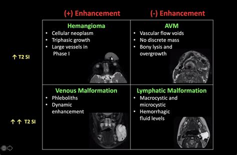 ISSVA Classification Of Vascular Anomalies A Simple GrepMed, 58% OFF