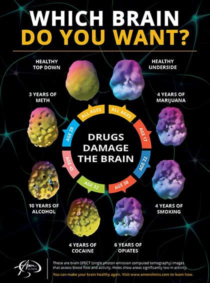 Brain Scan On Drugs - Brain Mind Article