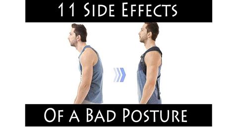 11 Side Effects Of a Bad Posture - YouTube