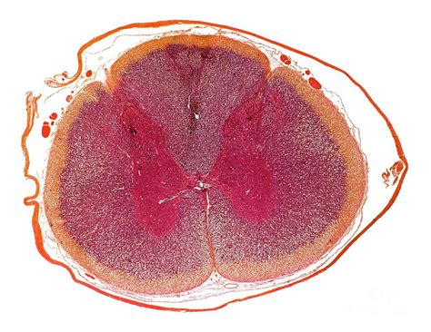 Cat Spinal Cord Photograph by Dr Keith Wheeler/science Photo Library