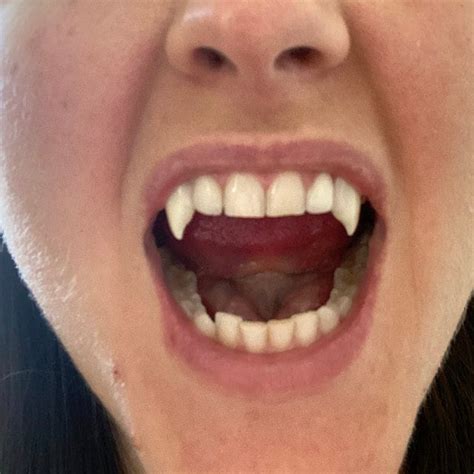 Vampire Teeth Fangs for Women or Teens That You Mold to | Etsy