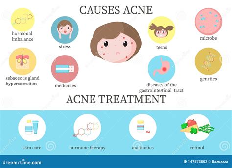 Acne Causes. Medical Banner With Dermatology Infographics. Girl Problem ...