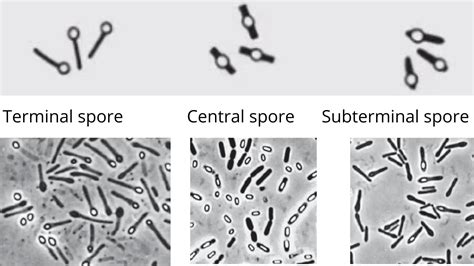 Classification of Bacteria – Microbe Online