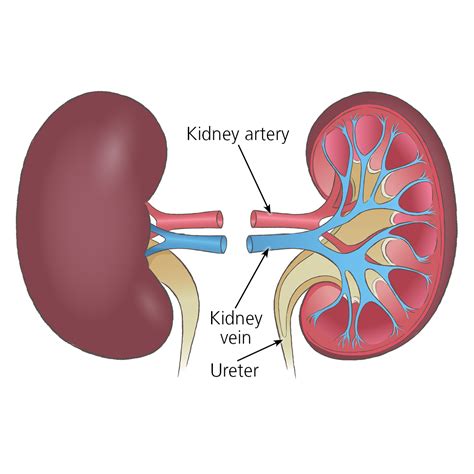 Kidney Transplant Surgery