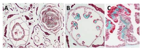 Histology cross of coral pharyngeal cavity of the polyp (A), six out of ...