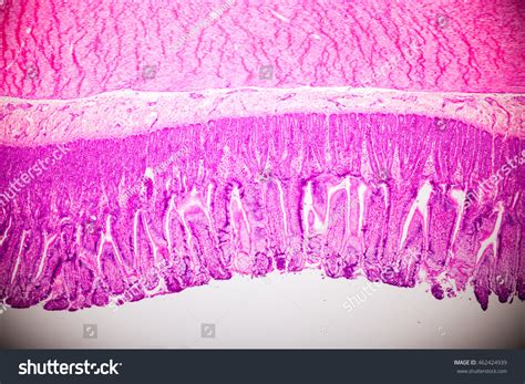 Simple Columnar Epithelium Under Microscope