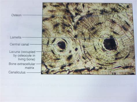 Osteon slide tissue histology | I'm a nurse | Pinterest