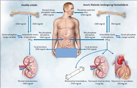 Pathophysiology of Hyperphosphatemia - Phosphate Control in Chronic ...