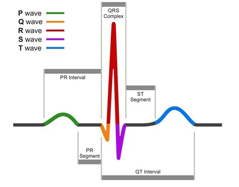 ECG Quiz: Interpreting cardiac waveforms