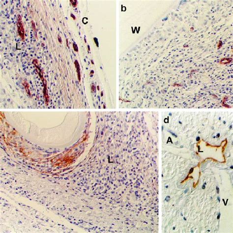 (PDF) The Association of Adult Onchocerca volvulus with Lymphatic Vessels