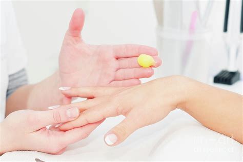 Hand Treatment Photograph by Microgen Images/science Photo Library - Pixels