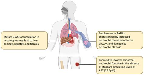 A Review of Alpha-1 Antitrypsin Binding Partners for Immune Regulation and Potential Therapeutic ...