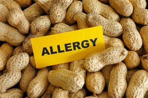 What Are Peanut Allergy Symptoms? | Food Allergies Atlanta