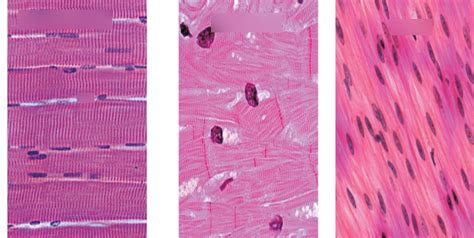 Muscle tissue- microscopic slides Diagram | Quizlet