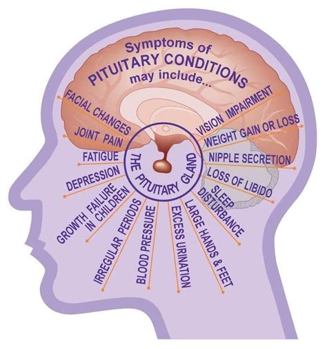 Pin by Mary Mahar on Nursing facts | Pituitary gland, Pituitary gland ...