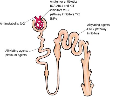 Nephrotoxicity in cancer treatment: An overview