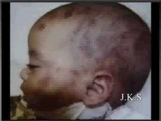 The Worst Case of Child Abuse In US History – The Murder of Baby ...