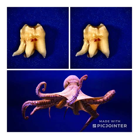 Do Octopus Have Teeth