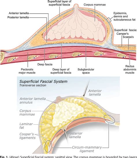 Anatomy of the Superficial Fascia System of the Breast: A Comprehensive ...