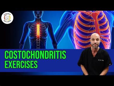 Costochondritis exercises – Artofit