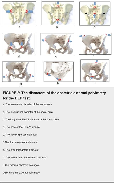 Table 1 from A Postural Approach to the Pelvic Diameters of Obstetrics ...