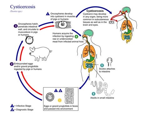 Taenia solium - Wikipedia