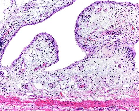 Synovial Membrane Photograph by Jose Calvo / Science Photo Library | Fine Art America