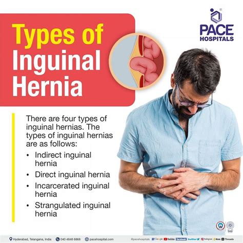 Inguinal Hernia - Signs and Symptoms, Types, Causes, Risk Factors