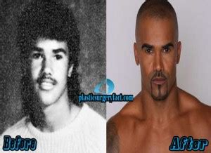 Shemar Moore Plastic Surgery Before and After - Plastic Surgery Facts