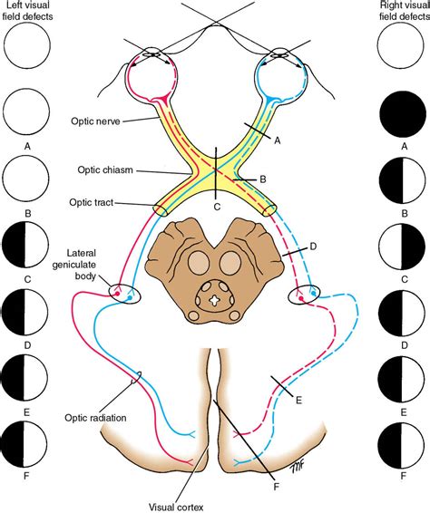 The Cranial Nerves | Radiology Key