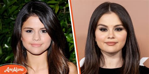 Selena Gomez & Plastic Surgery: Experts Claim She Had Work Done