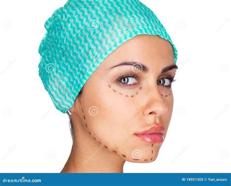 Marks for Facial Plastic Surgery Stock Image - Image of isolated, background: 18921303