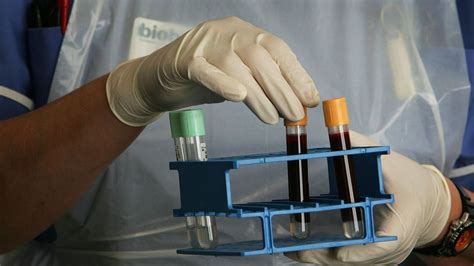 UK hospital to trial blood plasma Covid-19 treatment | The Week