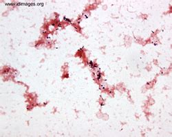 Listeria Images - Infectious Disease Images - eMicrobes Digital Library ...