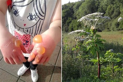 'Highly toxic' plant that can cause blindness found in Somerset village - Somerset Live