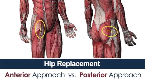 Posterior Vs Anterior