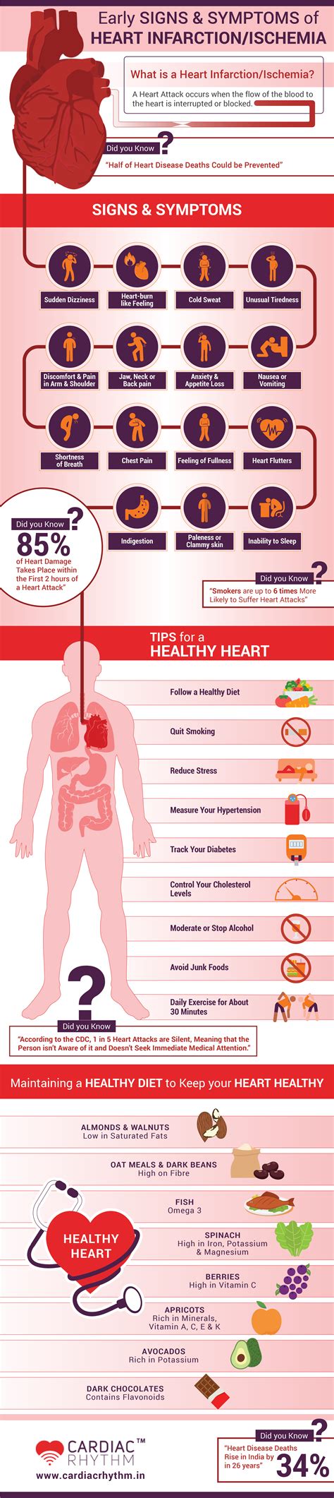 Early Signs & Symptoms of Heart Infarction / Ischemia – Infographic